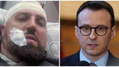 KURTIJEVI FALANGISTI BEZ POVODA KRVNIČKI PRETUKLI VLADANA STEVANOVIĆA Petković: Prebijanja i hapšenja Srba su očigledno vrednosti koje tzv. Kosovo "preporučuju" za Savet Evrope!