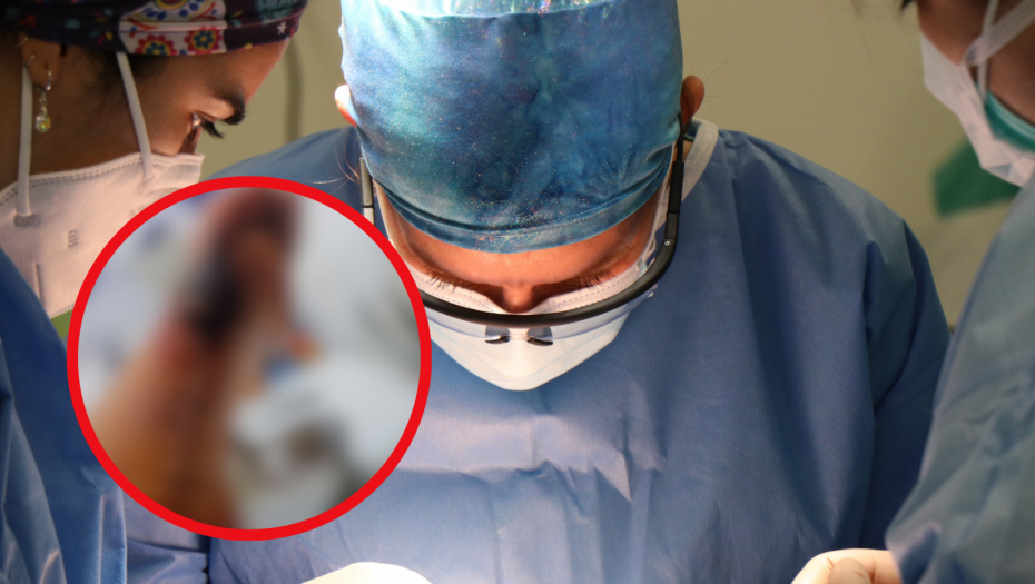 UZNEMIRUJUĆE, ŽENA OTIŠLA DA SREDI ZADEBLJANJE, NOGA JOJ IZGLEDA KAO DA JE BILA U RATU Zbog ovoga su uhapšeni lekar i kozmetičarka iz Beograda