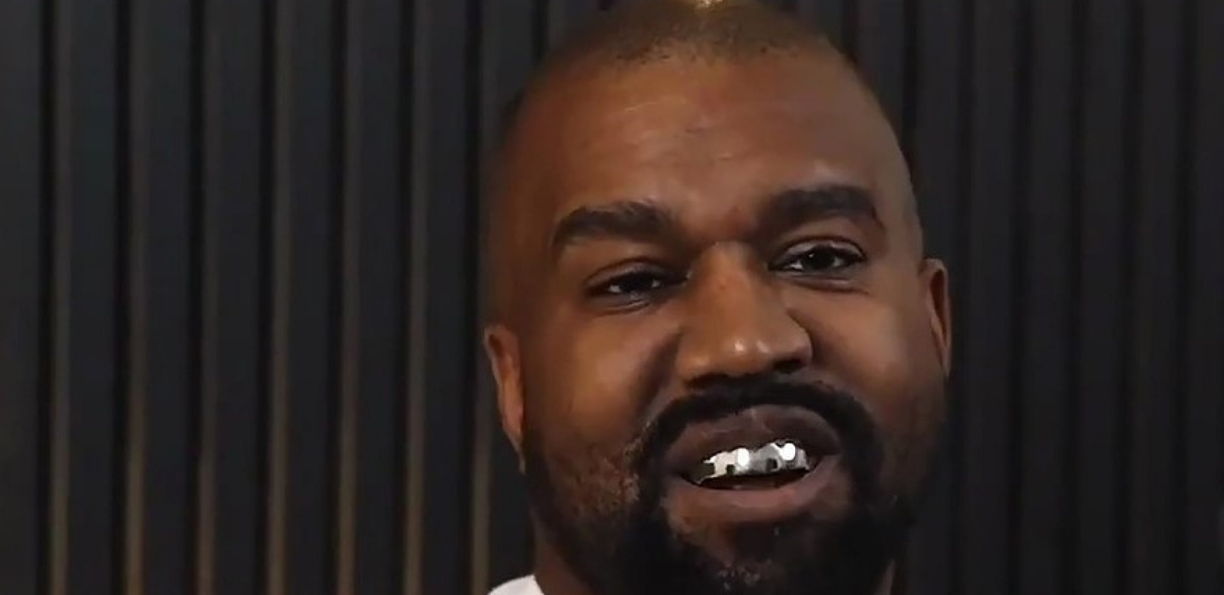 REPER PLATIO 850.000 HILJADA DOLARA ZUBE Kada se osmehnuo, nastao haos, pljušte komentari na društvenim mrežama