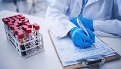 RANA DIJAGNOZA PARKINSONA PUTEM MIRISA Naučnici su razvili test prepoznavanja teške bolesti u začetku
