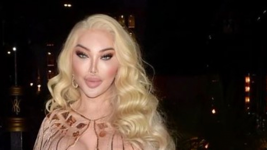KOŽA JOJ SE RASPADA I NE MOŽE DA DIŠE Nekada je bila muškarac a sada je živa lutka, i ne planira da stane sa operacijama! (FOTO)
