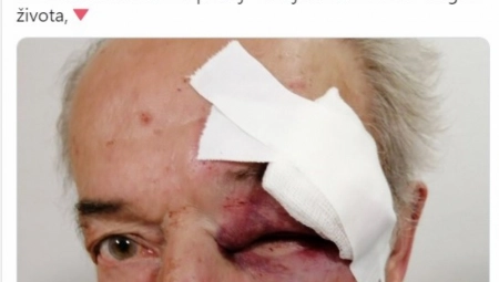 SASLUŠAN NAPADAČ KOJI JE BRUTALNO PRETUKAO GENERALA U PENZIJI Evo kako se branio pred tužilaštvom!