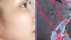 MANEKENKA PROŠLA KROZ SKENER NA AERODROMU Začulo se pištanje...kada je otkrila šta joj se nalazi u glavi, vilica joj je pala od šoka!