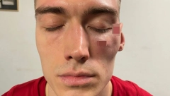 POLICIJA REAGOVALA ZBOG LAZAREVIĆA I NANELIJA Otkriveno šta će dalje da se dešava u vezi sa skandalom iz "Arene"