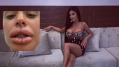 ZASTRAŠUJUĆE SLIKE ZADRUGARKE Pokazala kako sad izgleda, svi se zaprepastili