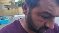 UŽASAVAJUĆE, POGLEDAJTE ŠTA JE OPOZICIJA URADILA ČOVEKU! Stravičan napad u Vajskoj! (FOTO)