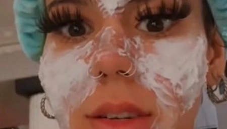 UPROPASTILA SE Žena je namazala kremu kojoj je istekao rok trajanja, lice joj je sada katastrofalno!