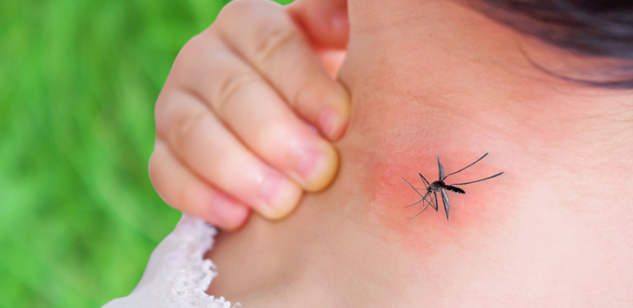 LETEĆE KRVOPIJE NAJVIŠE UJEDAJU LJUBITELJE PIVA! Komarci najviše vole ljude sa OVOM KRVNOM GRUPOM - da li ste među njima?!