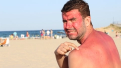 ZBOG JEDNE GREŠKE, BOLI I NASTAJU PLIKOVI Ako izgorite na suncu, dva sastojka su spas, ali samo ako ih ovako mažete