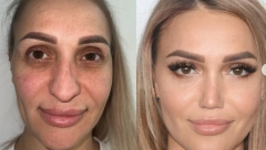 LJUDI ŠOKIRANI TRANSFORMACIJOM: "Nakon ove operacije trebaće joj nova dokumenta" (FOTO)