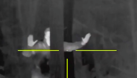 VOJNIK UBIJEN U SUKOBU Žestoko na severu fronta