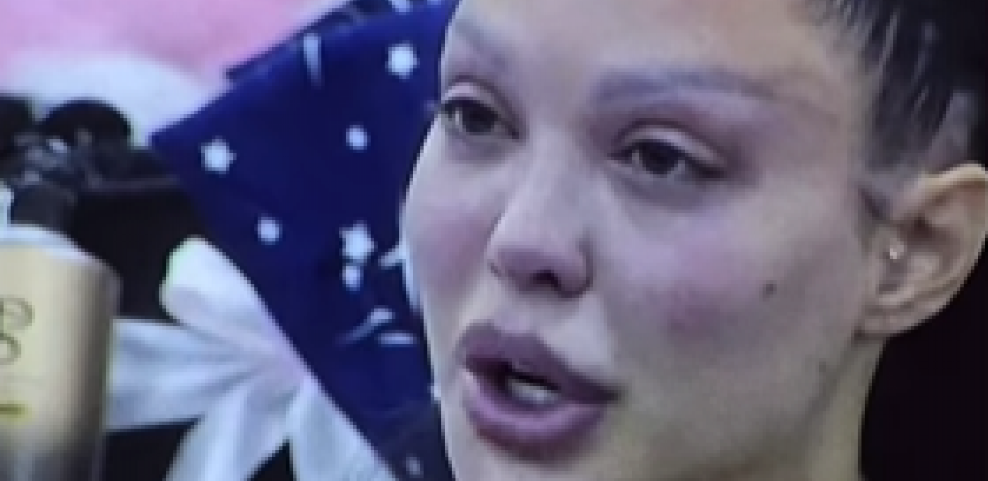 "HIRURG JOJ JE GREŠKOM SILIKONE ZA GRUDI STAVIO U ZADNJICU" Majina pozadina se potpuno izdeformisala, isplivale šokantne slike