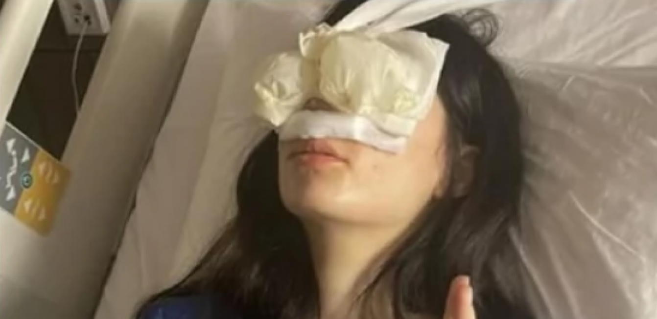 NISAM MOGLA SAMA DA USTANEM IZ KREVETA Našoj influenserki (23) lice prekriveno flasterima, poznato šta se desilo