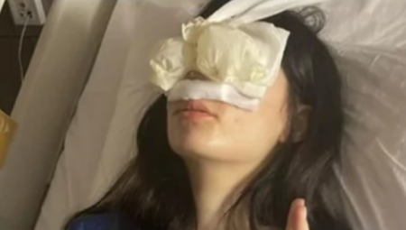 NISAM MOGLA SAMA DA USTANEM IZ KREVETA Našoj influenserki (23) lice prekriveno flasterima, poznato šta se desilo