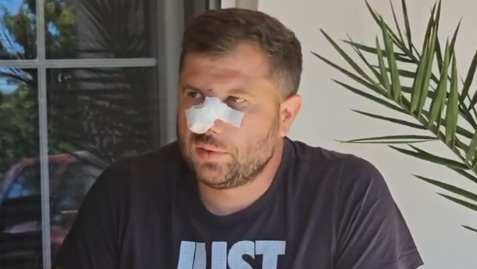 ALBANAC ME NAPAO BEZ RAZLOGA  Ispovest prebijenog Srbina na KiM: Policija je mene i oca maltretirala, umesto da nas zaštiti! (VIDEO)