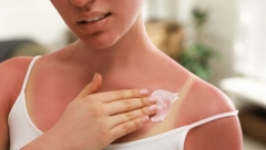 "IZGORELA SAM NA SUNCU, A SVEKRVIN TRIK ME SPASIO ZA POLA SATA" Fora je u proizvodu koji svi imamo kod kuće, a nije kiselo mleko