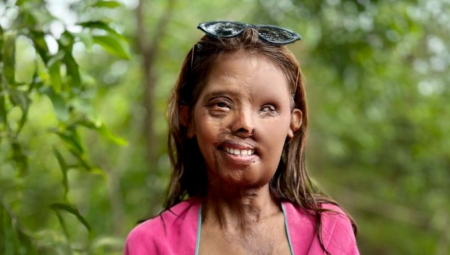 OTAC JE KAO BEBU POLIO KISELINOM, JER NIJE HTEO ĆERKU Završila je u sirotištu, a onda je preuzela stvari u svoje ruke!