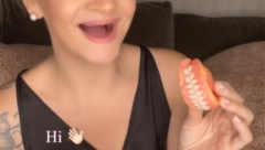 IZVADILA JE 23 ZUBA I NEĆE DA NOSI PROTEZU: "Volim svoja KREZAVA USTA i nije me briga ko šta misli!" (VIDEO)