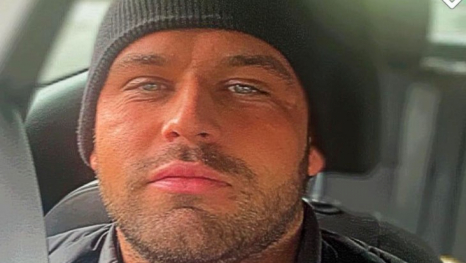 HTEO DA OFARBA SEDE, PA ZAMALO UMRO Deformisala mu se glava, zatim i lice, lekari jedva sprečili najgori scenario! (FOTO)