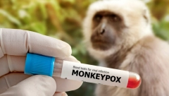 MAJMUNSKE BOGINJE PRED VRATIMA Šta treba da znate o ovom virusu i kako se zaštititi, postoji vakcina, ali...