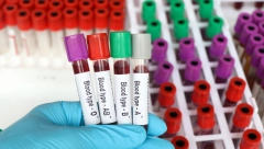 ZALIHE KRVI NA IZDISAJU! Apel građanima, evo GDE možete danas dati krv!