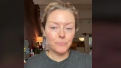 UMESTO BOTOKSA, ŽENE MASOVNO KORISTE JEDNO VOĆE Tvrde da zateže kožu lica i ublažava bore, a evo šta kažu dermatolozi