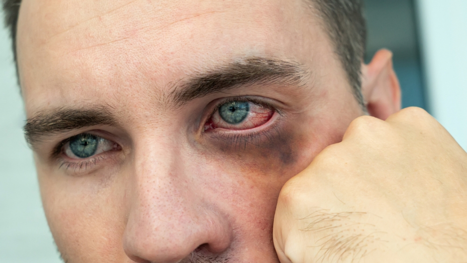 VIC DANA Naleti Mujo na Hasu na čaršiji, a ovaj ga iznenađeno pogleda...