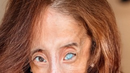 VREĐAJU JE I GOVORE DA JE NAJRUŽNIJA ŽENA NA SVETU Boluje od retkog sindroma i ima samo 29 kila, ali njena hrabrost je neverovatna! (FOTO)