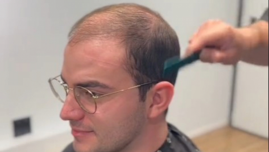 DA LI JE MOGUĆE DA JE OVO ISTA OSOBA? Frizer  neverovatnom transformacijom podmladio momka, ljudi na mrežama u neverici! (VIDEO)