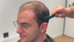 DA LI JE MOGUĆE DA JE OVO ISTA OSOBA? Frizer  neverovatnom transformacijom podmladio momka, ljudi na mrežama u neverici! (VIDEO)