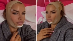 BIVŠA ZADRUGARKA SVA U ZAVOJIMA! Isplivao snimak nakon operacije: "Izobličila si se"