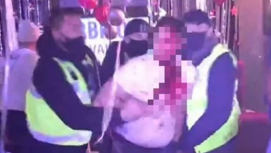 UDARA GLAVOM O ZID, KRV LIJE NA SVE STRANE! Ovo je najmonstruoznija scena u rijalitiju ikada, od ovih kadrova podilazi jeza!