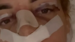 SKORO PA NOVO LICE! Bivša zadrugarka morala pod nož zbog zdravlja, a usput se i ulepšala