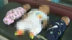 LEKARI NIKADA NISU VIDELI NEŠTO SLIČNO Mama je rodila trojke, ali se jedna beba potpuno razlikovala od ostalih