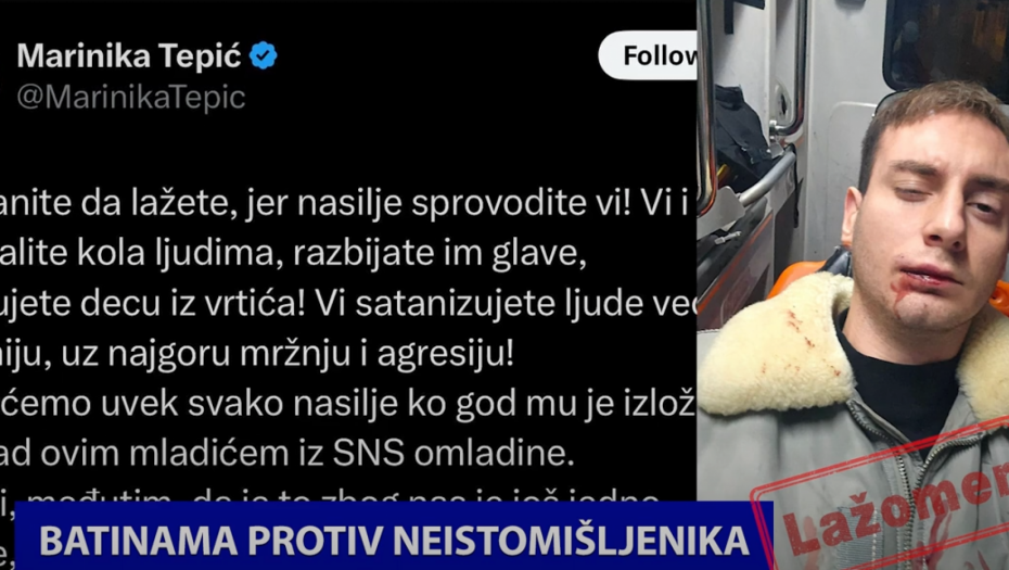 OPOZICIJA SE BATINAMA BORI PROTIV NEISTOMIŠLJENIKA! Politički analitičar prošao golgotu, za njih su uvrede i udarci LEGITIMNI (VIDEO)