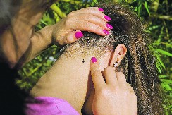 KRPELJI VREBAJU IZ TRAVE Počinje im sezona, ako ih ne uklonite na vreme, u problemu ste, ovo su simptomi