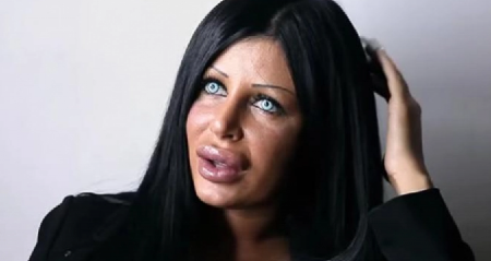 "KRALJICU SILIKONA" VIŠE NI ROĐENA MAJKA NE BI PREPOZNALA! Nestala iz javnosti, i povukla se, smanjila grudi, usne i potpuno se tranformisala (FOTO)
