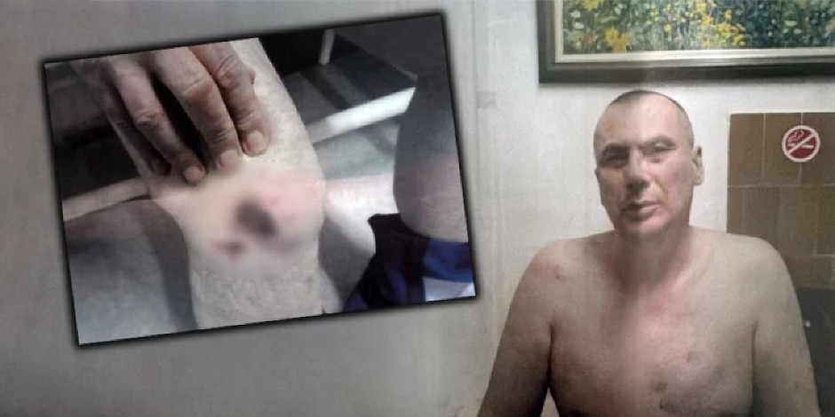 UZNEMIRUJUĆE FOTOGRAFIJE Prebijen zbog psovke, tortura policije nad advokatom - a napadači na dekana Drida i dalje na slobodi
