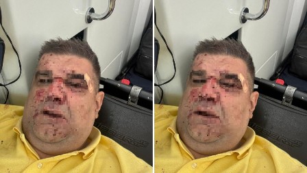 "POKUŠAJ UBISTVA!" Osvanula jeziva fotografija Saše Mirkovića nakon što je krvnički pretučen (FOTO)