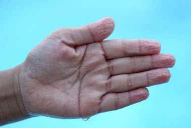 REZULTATI ISTRAŽIVANJA IZNENADILI NAUČNIKE Zabluda je razotkrivena - ovo je pravi razlog zašto se prsti smežuraju u vodi