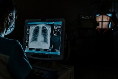 DVA OPASNA ZNAKA TROMBA U PLUĆIMA Lekari upozoravaju da ako ih osetite, morate odmah u bolnicu