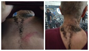 BLOKADERI BACILI BAKLJU NA PREDRAGA, GLEDAJTE KAKO JE PROŠAO Ima opekotine, ovo je jezivo! NIJE TO JEDINA KRV KOJU SU PROLILI