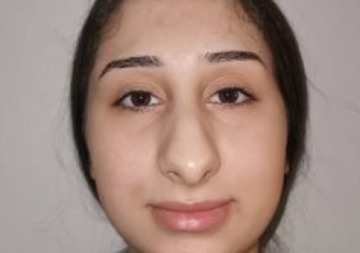 PLASTIČNE OPERACIJE KOJE ŠOKIRAJU Devojka u Turskoj drastično promenila izgled, mreže pucaju od reakcija! (FOTO)