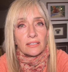 DO 35. NIJE IMALA NIJEDNU BORU, JER JE NA LICE STAVLJALA OVO Insistira da ne bacate pare na skupe kreme, nego da odete u supermarket i kupite...