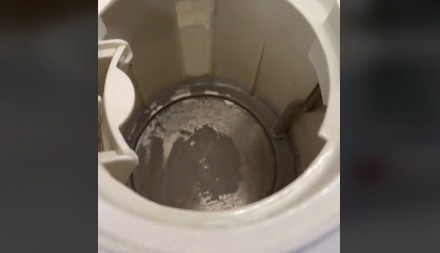 RECITE ZBOGOM KAMENCU U KUVALU Uklonite ga ovom prirodnom mešavinom koja čini čuda