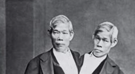 SIJAMSKI BLIZANCI IMALI 22 DECE! Tajne njihove ljubavne veze šokirale svet