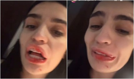 NAŠU INFLUENSERKU PRETUKAO DEČKO! Sva krvava i uplakana, jeca na sav glas: Zapamtićeš me za ovo! (FOTO)