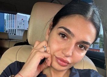 "POBESNEO JE I UDARIO ME JE" Prvo oglašavanje Tamare Bojanić nakon što ju je prebio dečko: Ovo nije prvi da je nasilan!