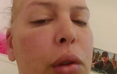 AVA KARABATIĆ POTPUNO IZOBLIČENA! Procurila stravična fotka, svi zabrinuti za njeno stanje, završila na lečenju!