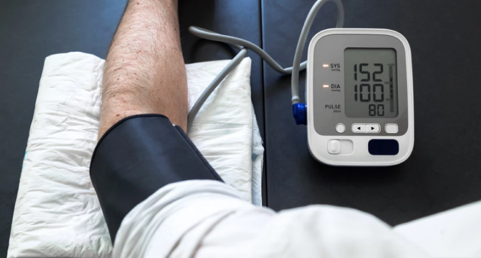 VARIRANJE PRITISKA I NAGLE PROMENE VREMENA Doktori upozoravaju na jedan opasan simptom